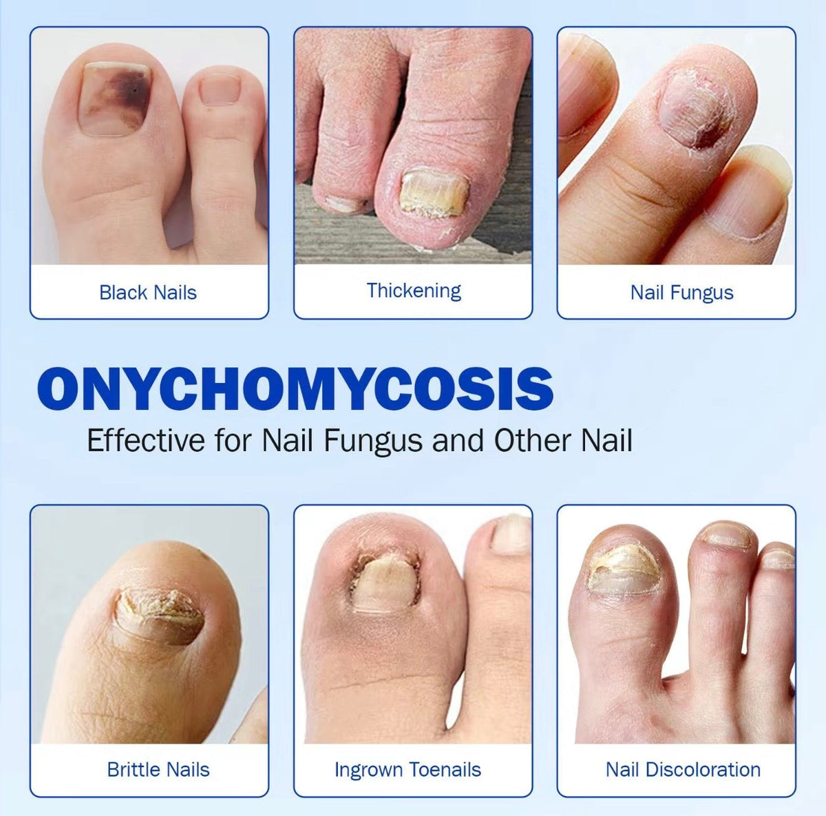 FungaFix Nail Patches