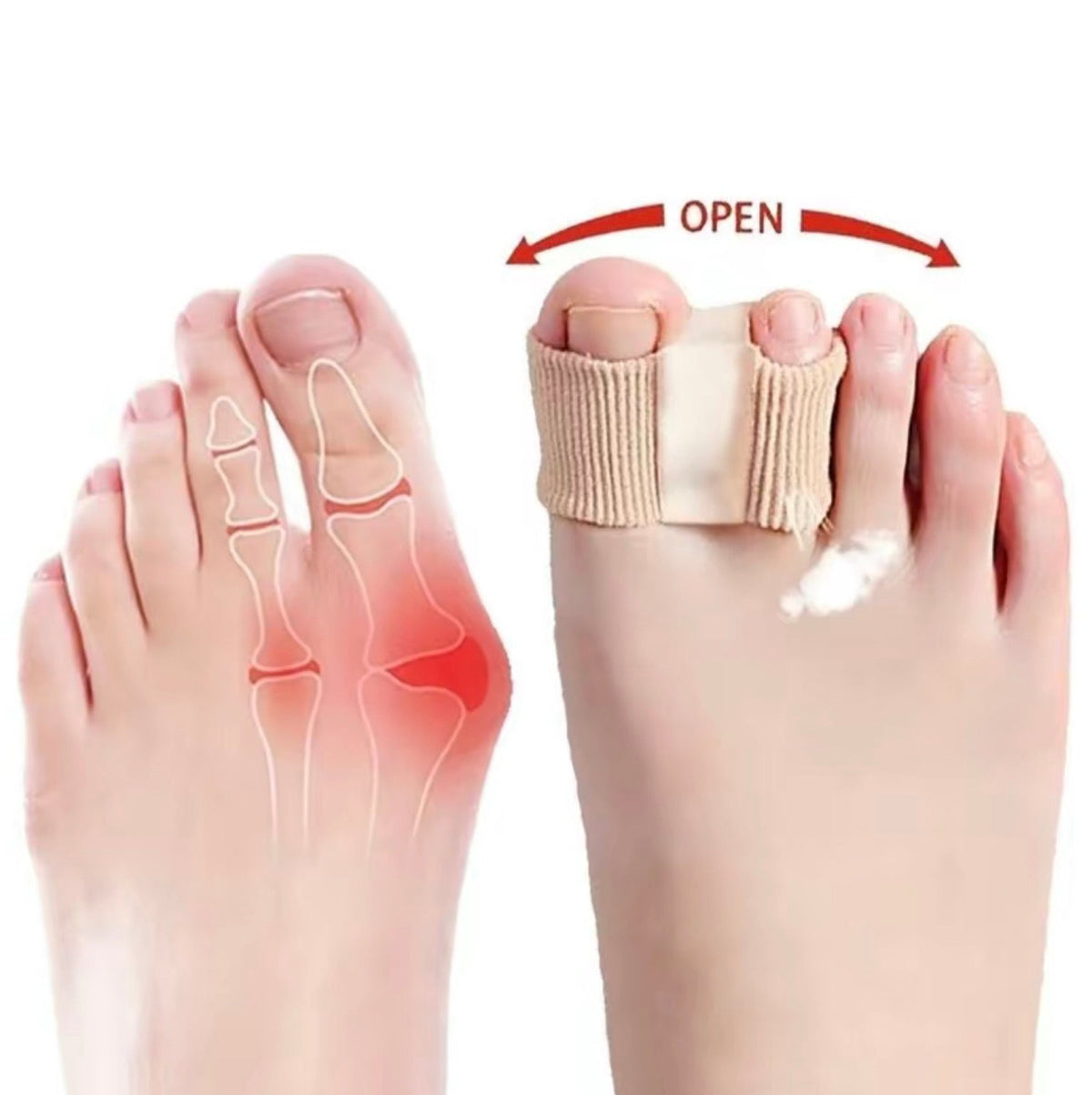 BunionEase Toe Separators